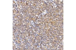 Immunohistochemistry of paraffin-embedded human tonsil using NF Rabbit pAb (ABIN3017384, ABIN3017385, ABIN3017386 and ABIN6220063) at dilution of 1:100 (40x lens). (NFAT1 antibody)