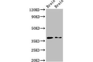 Western Blot Positive WB detected in: Rat brain tissue, Mouse brain tissue All lanes: PEX10 antibody at 2. (PEX1 antibody  (AA 63-157))