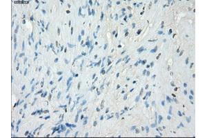 Immunohistochemical staining of paraffin-embedded Ovary tissue using anti-PRKAR1Amouse monoclonal antibody. (PRKAR1A antibody)