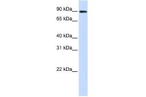 DLG3 antibody used at 1 ug/ml to detect target protein. (DLG3 antibody)