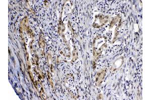 IHC analysis of MED4 using anti-MED4 antibody . (MED4 antibody  (AA 27-140))