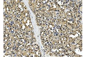 IHC analysis of CSNK2B using anti-CSNK2B antibody (ABIN7599092).