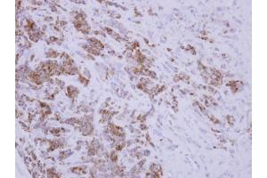 IHC-P Image Immunohistochemical analysis of paraffin-embedded BT483 xenograft, using TID1, antibody at 1:250 dilution. (DNAJA3 antibody  (Center))