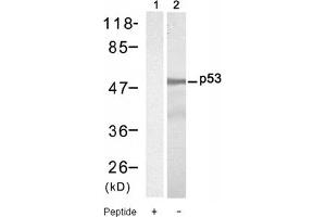 Image no. 1 for anti-Tumor Protein P53 (TP53) (Ser9) antibody (ABIN319301) (p53 antibody  (Ser9))