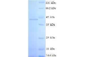 SDS-PAGE (SDS) image for RAB3C, Member RAS Oncogene Family (Rab3c) (AA 1-227), (full length) protein (His-SUMO Tag) (ABIN4974399) (Rab3c Protein (AA 1-227, full length) (His-SUMO Tag))