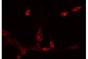 ABIN6275761 staining HeLa by IF/ICC. (CYP11A1 antibody  (C-Term))