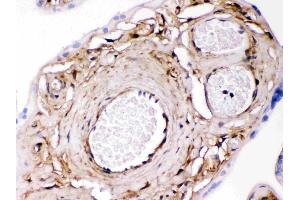 Galectin 1 was detected in paraffin-embedded sections of human placenta tissues using rabbit anti- Galectin 1 Antigen Affinity purified polyclonal antibody (Catalog # ) at 1 µg/mL. (LGALS1/Galectin 1 antibody  (AA 2-135))
