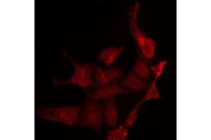 ABIN6275140 staining LOVO by IF/ICC. (GABRg1 antibody  (N-Term))