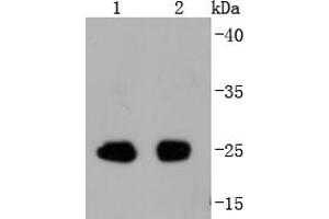 Lane 1: Mouse spleen, Lane 2: Rat spleen cell lysate probed with eIF4E(S209) (2B1) Monoclonal Antibody  at 1:1000 overnight at 4˚C. (EIF4E antibody  (pSer209))