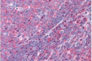 ABIN185286 (3. (FNBP1 antibody  (Internal Region))