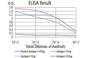 Black line: Control Antigen (100 ng),Purple line: Antigen (10 ng), Blue line: Antigen (50 ng), Red line:Antigen (100 ng) (GFPT1 antibody  (AA 536-681))