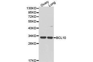 Western Blotting (WB) image for anti-B-Cell CLL/lymphoma 10 (BCL10) antibody (ABIN1871246) (BCL10 antibody)