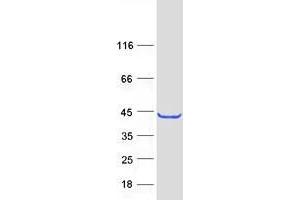 Validation with Western Blot (TRUB1 Protein (Myc-DYKDDDDK Tag))