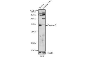Western blot analysis of extracts from normal (control) and Caspase-3 knockout (KO) 293T cells, using Caspase-3 antibody (ABIN6131582, ABIN6137962, ABIN6137964 and ABIN6215049) at 1:1000 dilution. (Caspase 3 antibody  (AA 55-160))