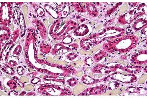 Human Kidney, Tubules: Formalin-Fixed, Paraffin-Embedded (FFPE) (ACP2 antibody  (AA 1-424))