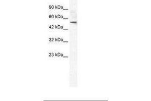 Image no. 2 for anti-Sphingomyelin phosphodiesterase, Acid-Like 3B (SMPDL3B) (AA 88-137) antibody (ABIN6735957)