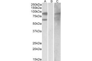 HEK293 lysate (10ug protein in RIPA buffer) overexpressing Human RACGAP1 with DYKDDDDK tag probed with ABIN2564849 (0. (RACGAP1 antibody  (C-Term))