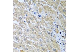 Immunohistochemistry of paraffin-embedded human liver using WDR48 antibody (ABIN5974731) at dilution of 1/100 (40x lens).