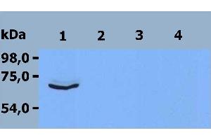 Western Blotting analysis (reducing conditions) of HPB-ALL peripheral blood T cell leukemia cell line (1, 3) and RAMOS human Burkitt lymphoma cell line (2, 4); Lane 1, 2: immunostaining with anti-ZAP-70 ; 0. (ZAP70 antibody  (C-Term))