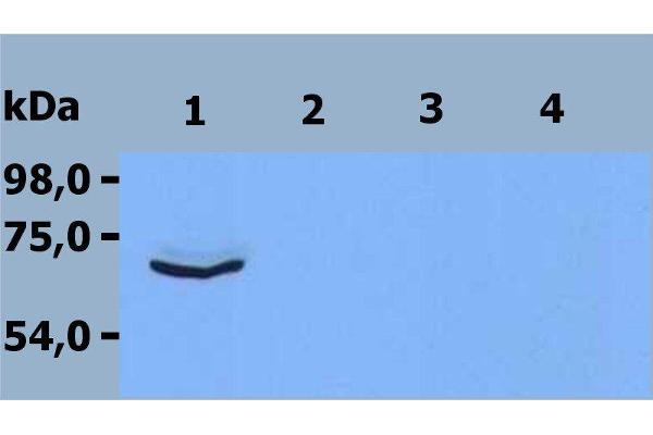 ZAP70 antibody  (C-Term)