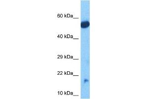 Host:  Rabbit  Target Name:  NDUFB11  Sample Tissue:  Human Lung Tumor lysates  Antibody Dilution:  1ug/ml (NDUFB11 antibody  (C-Term))