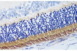 Immunohistochemistry of paraffin-embedded Rat retina using PDE6B Polyclonal Antibody at dilution of 1:200 (40x lens). (PDE6B antibody)