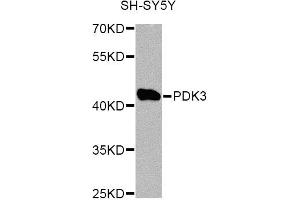 Western blot analysis of extracts of SH-SY5Y cells, using PDK3 Antibody. (PDK3 antibody)