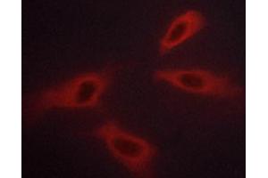 Immunofluorescence (fixed cells) (IF/ICC) image for anti-C-Abl Oncogene 1, Non-Receptor tyrosine Kinase (ABL1) (pTyr245) antibody (ABIN6256686)