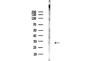 anti-Solute Carrier Family 39 (Zinc Transporter), Member 9 (SLC39A9) (Internal Region) antibody