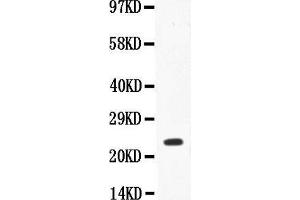 Anti-IL18 Picoband antibody,  All lanes: Anti-IL18 at 0.