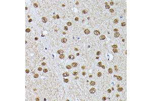 Immunohistochemistry of paraffin-embedded mouse brain using HNRNPL antibody (ABIN6128048, ABIN6141915, ABIN6141917 and ABIN6216076) at dilution of 1:100 (40x lens).