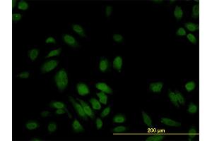 Immunofluorescence of monoclonal antibody to S100A6 on HeLa cell. (S100A6 antibody  (AA 1-90))