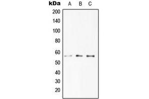 Western blot analysis of DR4 expression in HeLa (A), Jurkat (B), RAW264. (DR4 antibody  (C-Term))