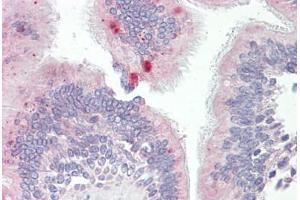 AP3M1 antibody  (AA 140-190)