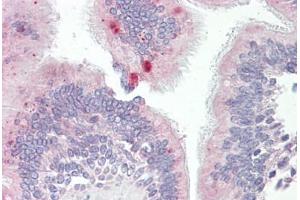Anti-AP3M1 antibody IHC staining of human lung, respiratory epithelium.