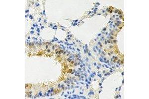 Immunohistochemical analysis of PPX staining in rat lung formalin fixed paraffin embedded tissue section. (PPP4C antibody)