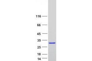 Leucine Rich Repeat Containing 75A (LRRC75A) (Transcript Variant 2) protein (Myc-DYKDDDDK Tag)