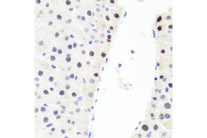 Immunohistochemistry of paraffin-embedded rat liver using RUNX1 antibody (ABIN6291786) at dilution of 1:100 (40x lens). (RUNX1 antibody)