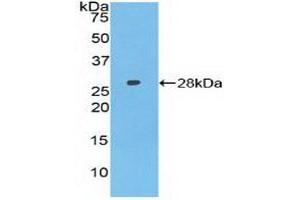 Detection of Recombinant AXIN, Human using Polyclonal Antibody to Axis Inhibition Protein (AXIN) (Axin antibody  (AA 653-862))