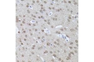 Immunohistochemistry of paraffin-embedded mouse brain using RNF166 antibody (ABIN5974659) (40x lens). (RNF166 antibody)