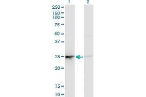 Western Blot analysis of PSMD10 expression in transfected 293T cell line by PSMD10 monoclonal antibody (M19), clone 3F10. (PSMD10 antibody  (AA 1-226))