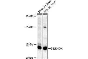 Western blot analysis of extracts of various cell lines, using SELENOK antibody (ABIN7270194) at 1:1000 dilution. (Selenoprotein K (SELENOK) antibody)