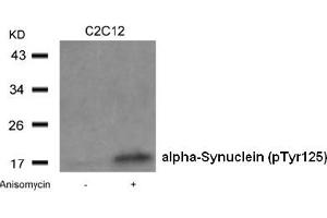 Image no. 2 for anti-Synuclein, alpha (SNCA) (pTyr125) antibody (ABIN401547) (SNCA antibody  (pTyr125))