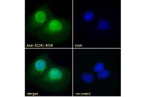 ABIN185043 Immunofluorescence analysis of paraformaldehyde fixed U2OS cells, permeabilized with 0. (BCOR antibody  (N-Term))