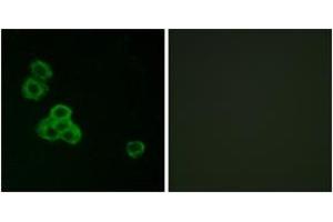 Immunofluorescence analysis of MCF7 cells, using CaMK2 alpha/delta (Ab-286) Antibody. (CaMK2 alpha/delta antibody  (AA 256-305))