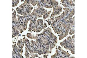 IHC analysis of hnRNP L/HNRNPL using anti-hnRNP L/HNRNPL antibody (ABIN7600130). (HNRNPL antibody  (AA 152-569))