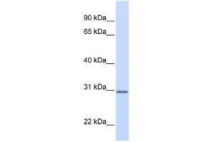 DCI antibody used at 1 ug/ml to detect target protein. (DCI antibody)