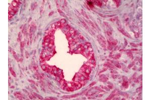 Anti-SMO antibody IHC of human prostate. (SMO antibody)