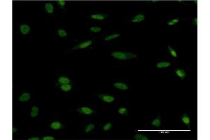 Immunofluorescence of monoclonal antibody to HCLS1 on HeLa cell. (HCLS1 antibody  (AA 266-355))