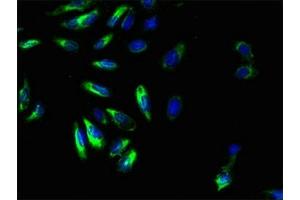 Immunofluorescent analysis of Hela cells using ABIN7153327 at dilution of 1:100 and Alexa Fluor 488-congugated AffiniPure Goat Anti-Rabbit IgG(H+L) (GPR161 antibody  (AA 1-28))